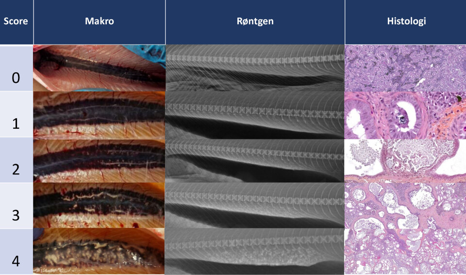 Skåringssystem som viser graden av alvorlighet slik øye ser det, ved røntgen og mikroskopbilder av vev (histologi). Skåringssystem som viser graden av alvorlighet slik øye ser det, ved røntgen og mikroskopbilder av vev (histologi).