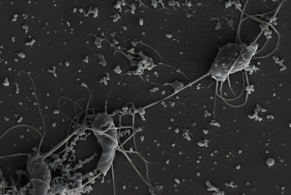 Parasitten Spironucleus salmonicida sett gjennom elektronmikroskopi.